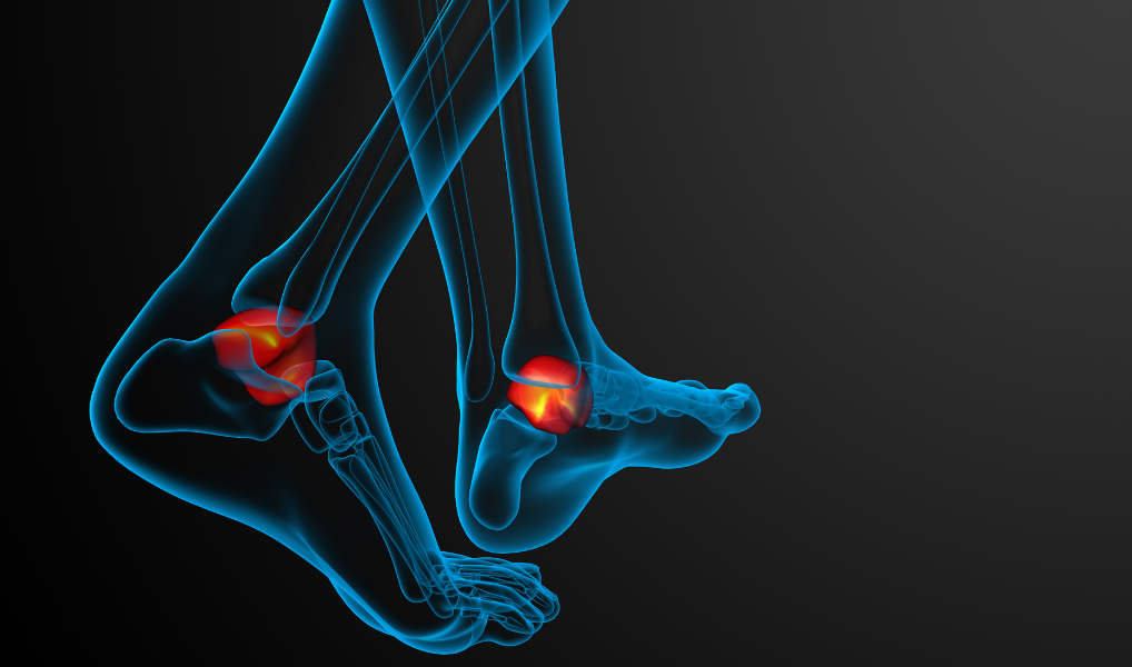 Achilles Health: Importance of Balancing 3 Planes of Motion